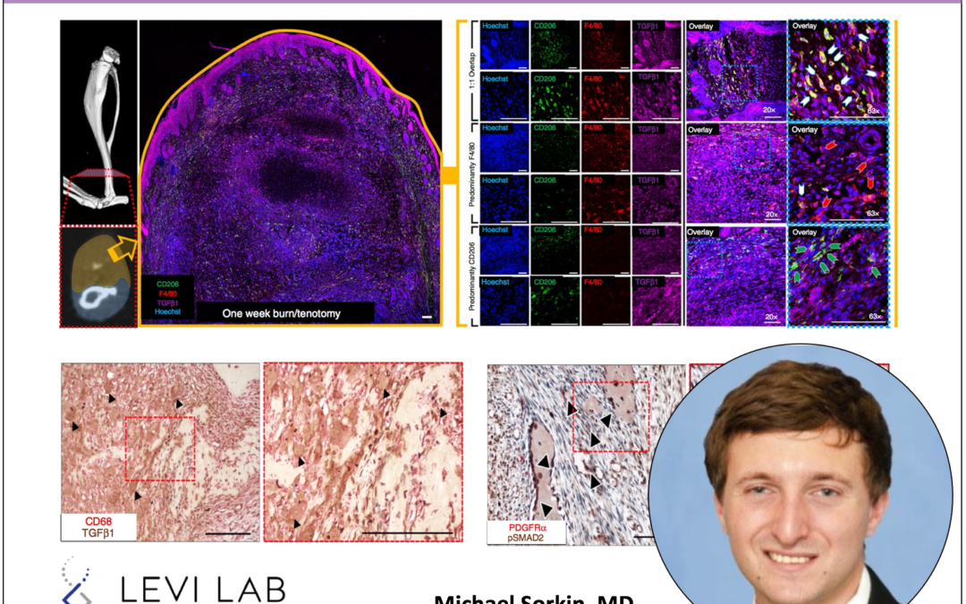 Several variants of macrophages seen at burn/tenotomy injury site - Michael Sorkin